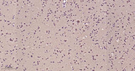 自噬微管相关蛋白轻链3重组兔单抗