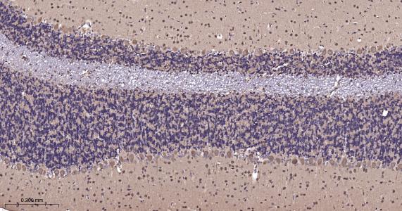 周期素依赖性激酶5重组兔单抗