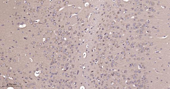 周期素依赖性激酶5重组兔单抗