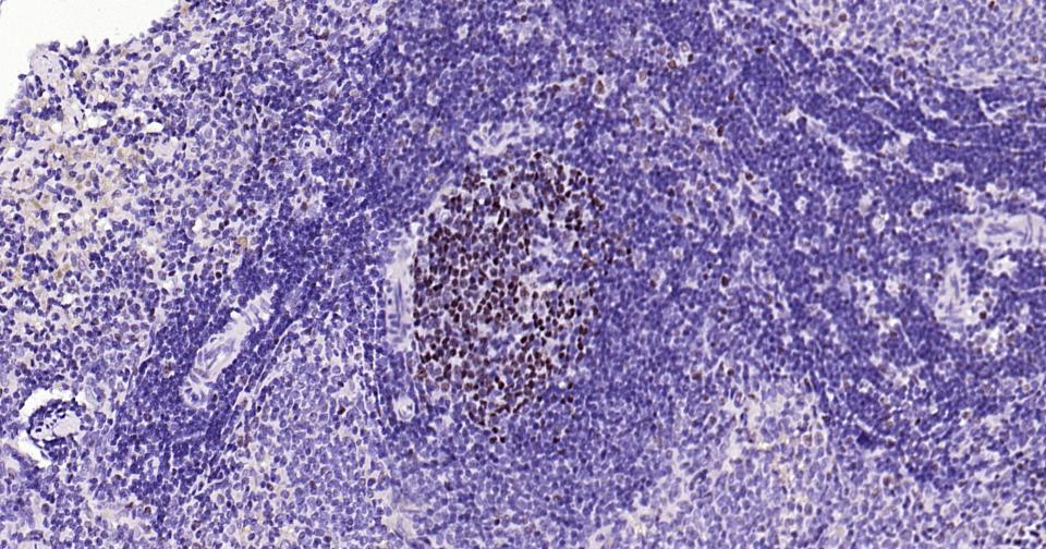 抑癌蛋白EZH2重组兔单抗