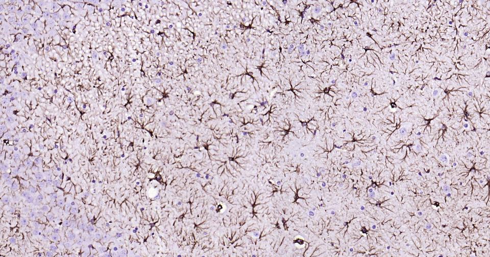 胶质纤维酸性蛋白重组兔单抗