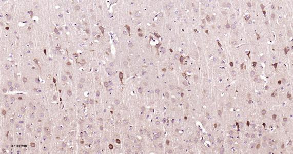 神经生长因子β重组兔单抗