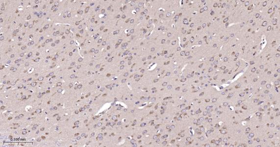 周期素依赖性激酶5重组兔单抗