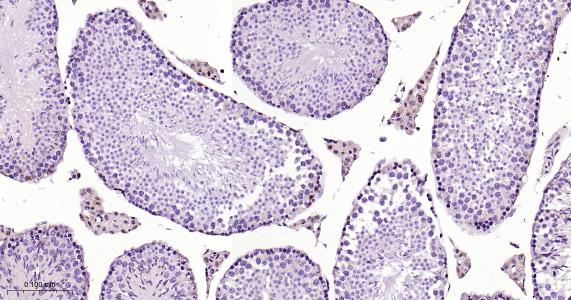 P27/周期素依赖激酶抑制剂重组兔单抗