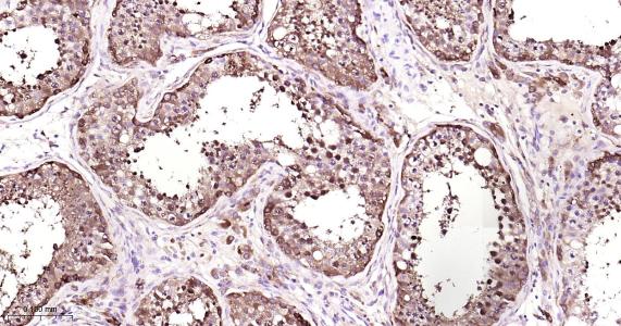 铁蛋白重组兔单抗