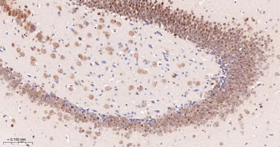 异构核糖核蛋白E2重组兔单抗