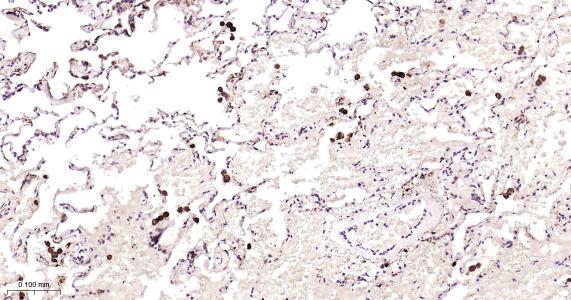 铁蛋白重组兔单抗