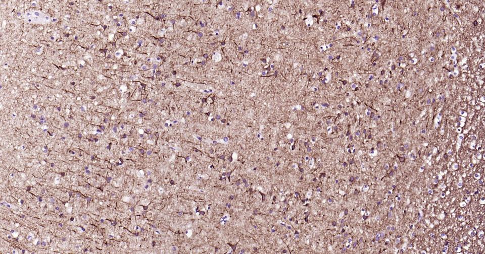 α-中连蛋白重组兔单抗