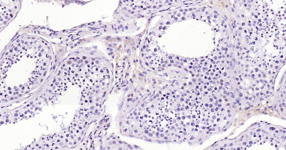 抑癌蛋白EZH2重组兔单抗