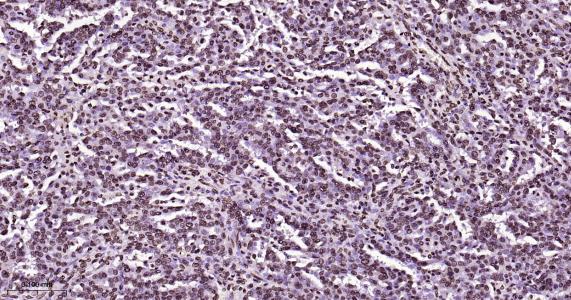 磷酸化雌激素受体ER alpha 重组兔单抗