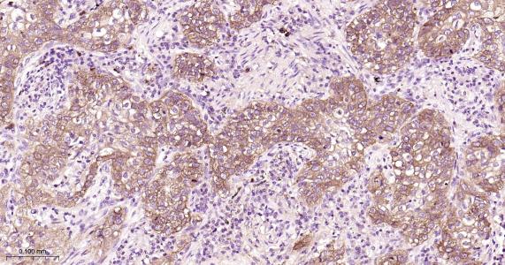 表皮生长因子受体重组兔单抗