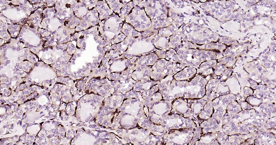 白介素4重组兔单抗