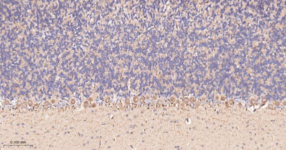 酰基辅酶A合成酶4重组兔单抗