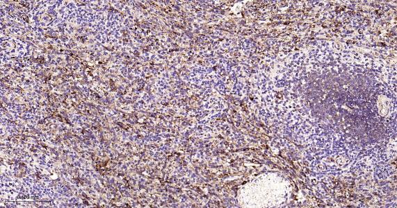 铁蛋白重组兔单抗