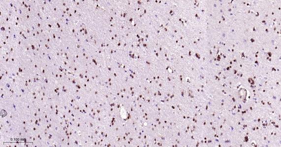 P27/周期素依赖激酶抑制剂重组兔单抗