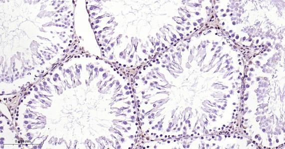 P27/周期素依赖激酶抑制剂重组兔单抗
