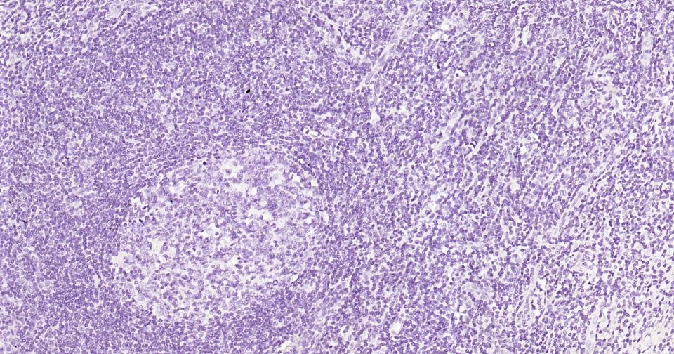 α-中连蛋白重组兔单抗