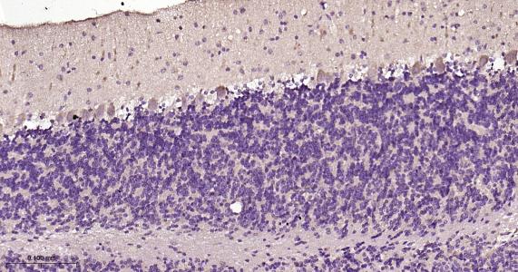 自噬微管相关蛋白轻链3重组兔单抗