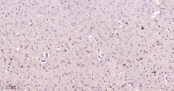 神经生长因子β重组兔单抗