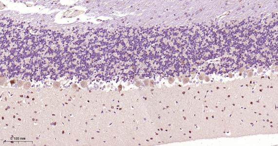 神经生长因子β重组兔单抗