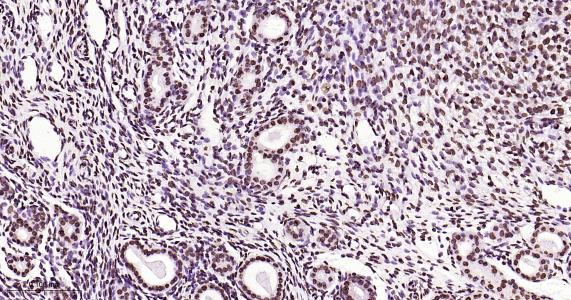 磷酸化雌激素受体ER alpha 重组兔单抗