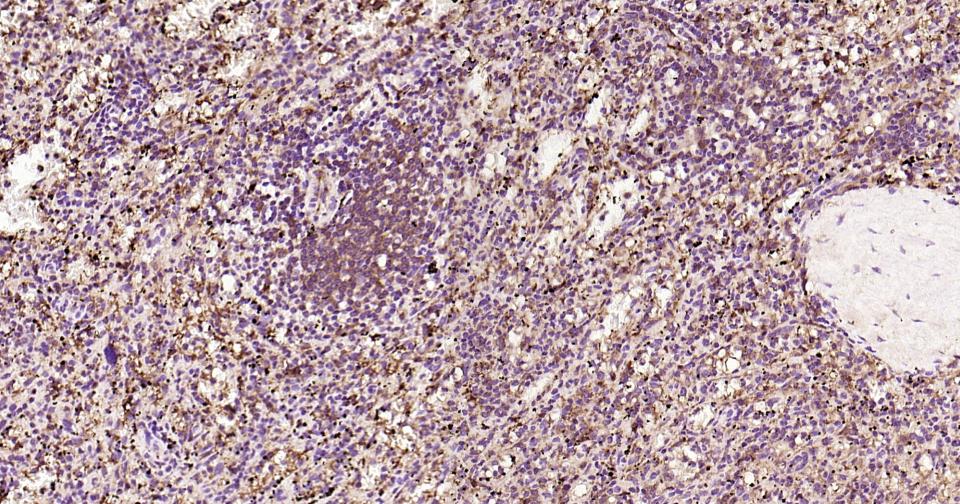 白介素4重组兔单抗