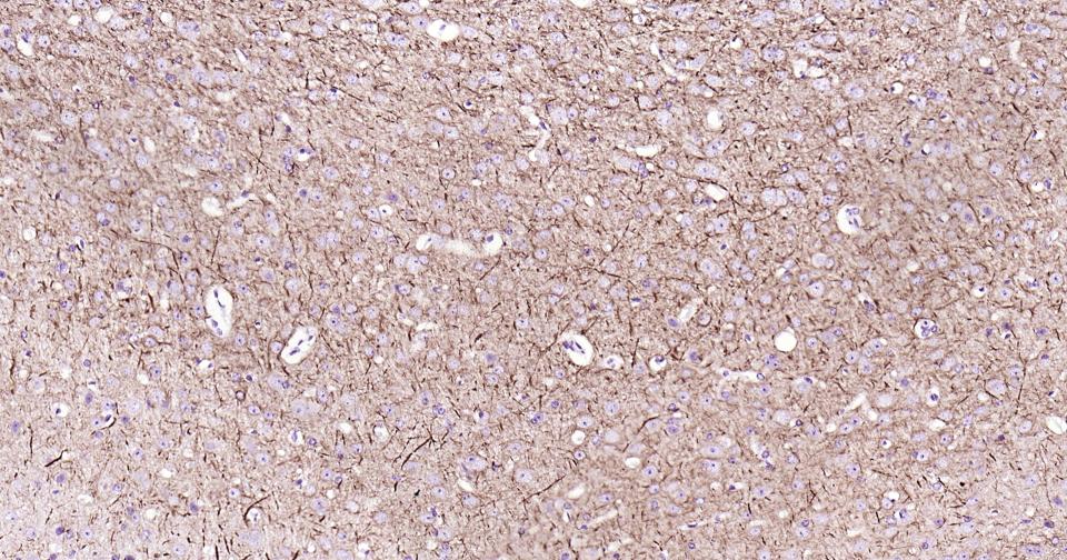 α-中连蛋白重组兔单抗