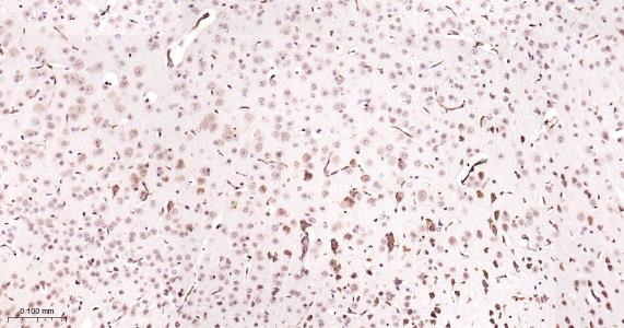 糖原合酶激酶-3β重组兔单抗