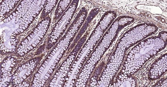 突触素样蛋白1重组兔单抗