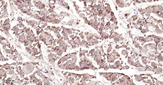 自噬微管相关蛋白轻链3重组兔单抗