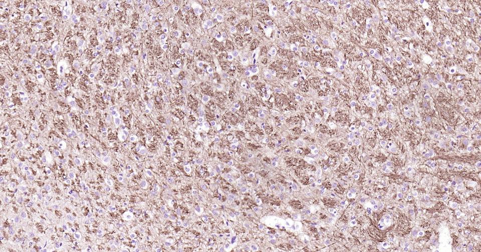 α-中连蛋白重组兔单抗