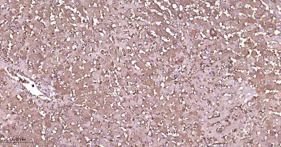 铁蛋白重组兔单抗