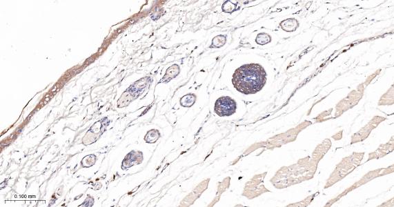 异构核糖核蛋白E2重组兔单抗
