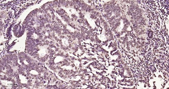 磷酸化雌激素受体ER alpha 重组兔单抗