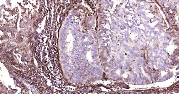 铁蛋白重组兔单抗