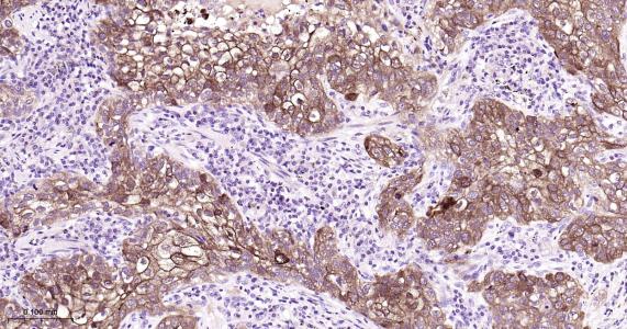 磷酸化表皮生长因子受体重组兔单抗