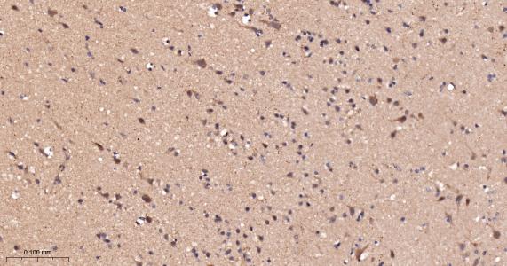 酰基辅酶A合成酶4重组兔单抗