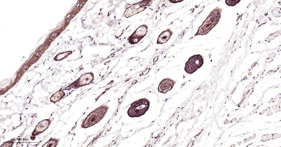 表皮生长因子受体重组兔单抗