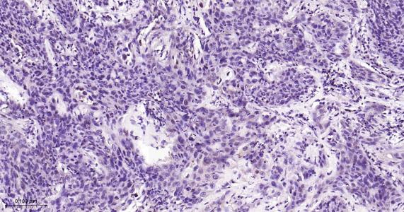P27/周期素依赖激酶抑制剂重组兔单抗