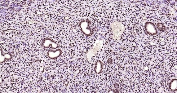 磷酸化雌激素受体ER alpha 重组兔单抗