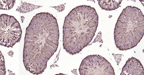 自噬微管相关蛋白轻链3重组兔单抗