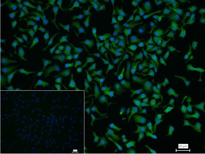 GATA结合蛋白4重组兔单抗