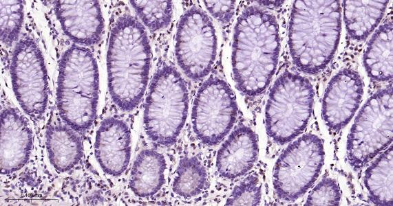 P27/周期素依赖激酶抑制剂重组兔单抗