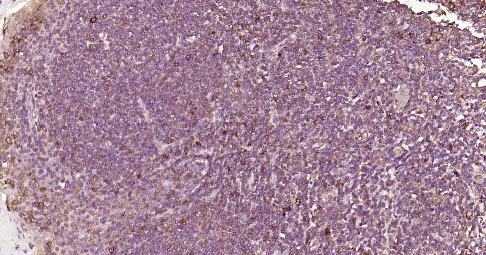 白介素4重组兔单抗