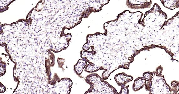 表皮生长因子受体重组兔单抗