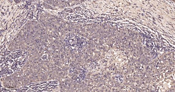 超氧化物歧化酶1重组兔单抗