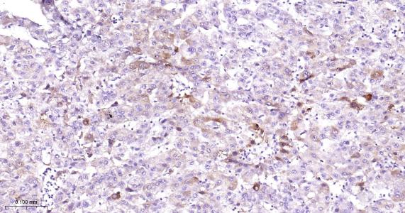 环氧合酶2重组兔单抗