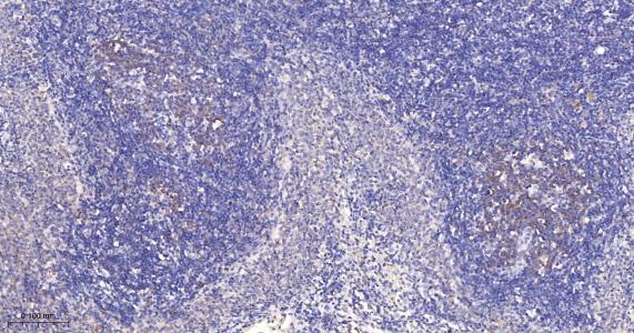 异构核糖核蛋白E2重组兔单抗