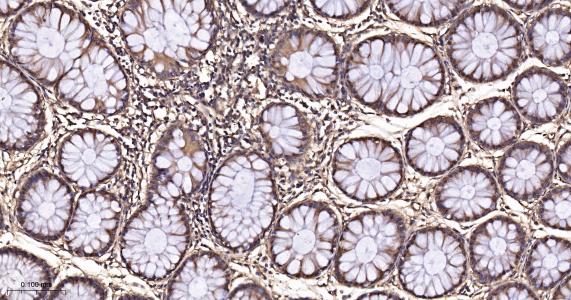 超氧化物歧化酶1重组兔单抗