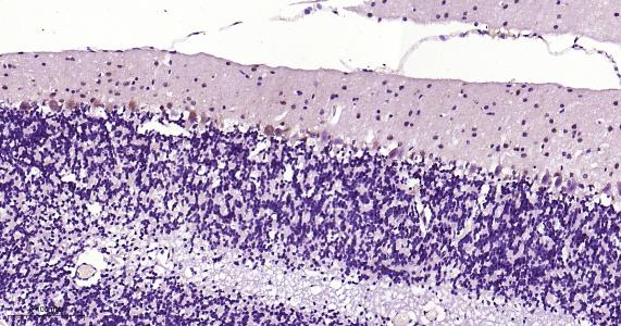 神经生长因子β重组兔单抗